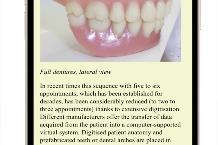 Dental-Dictionary.eu focus text e.g. dentures